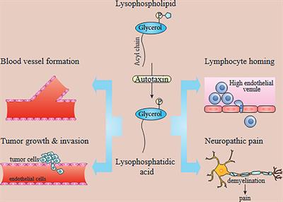 Lysophosphatidic Acid Signaling and microRNAs: New Roles in Various Cancers